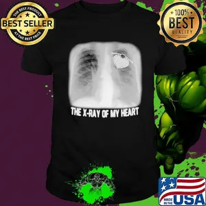 The X-ray Of My Heart Black White Shirt